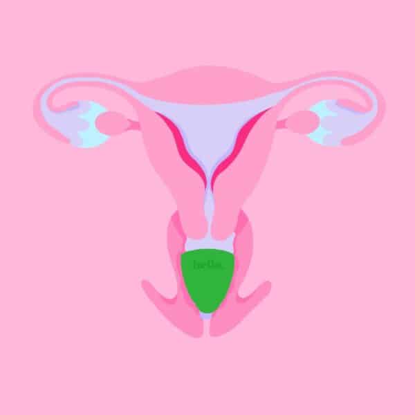 Hello Cup for Low Cervix